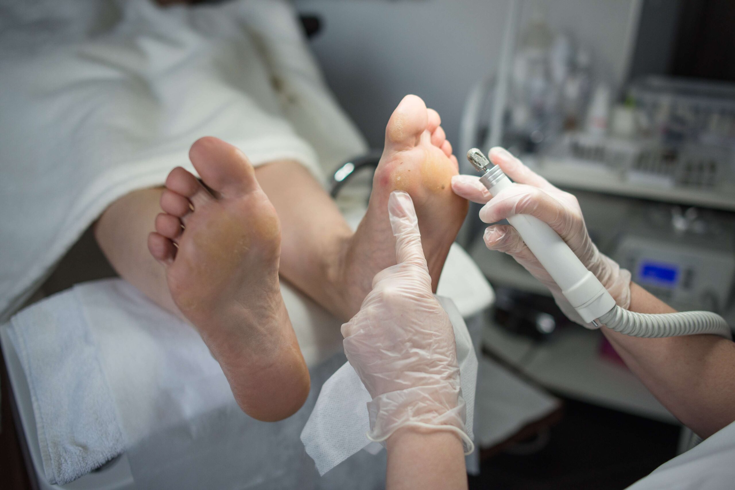 Diabetic Foot