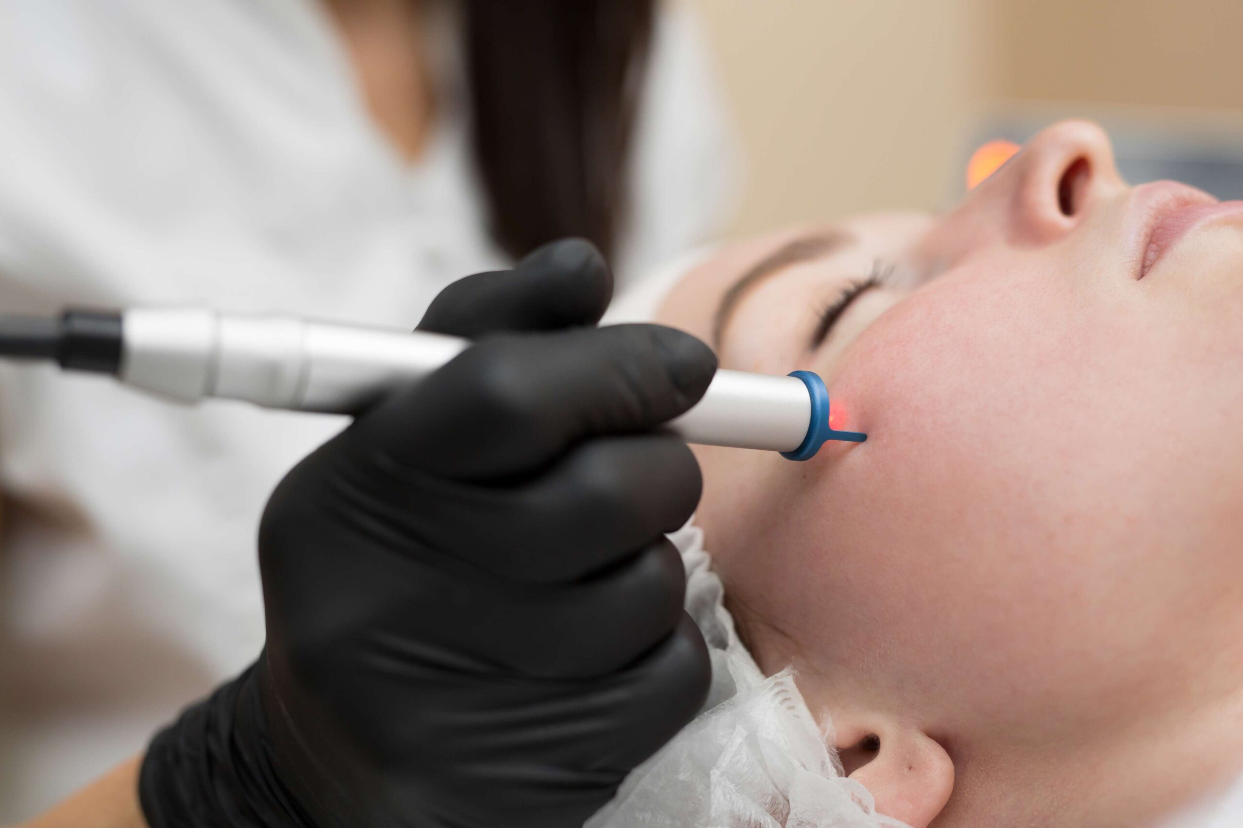Laser Treatment